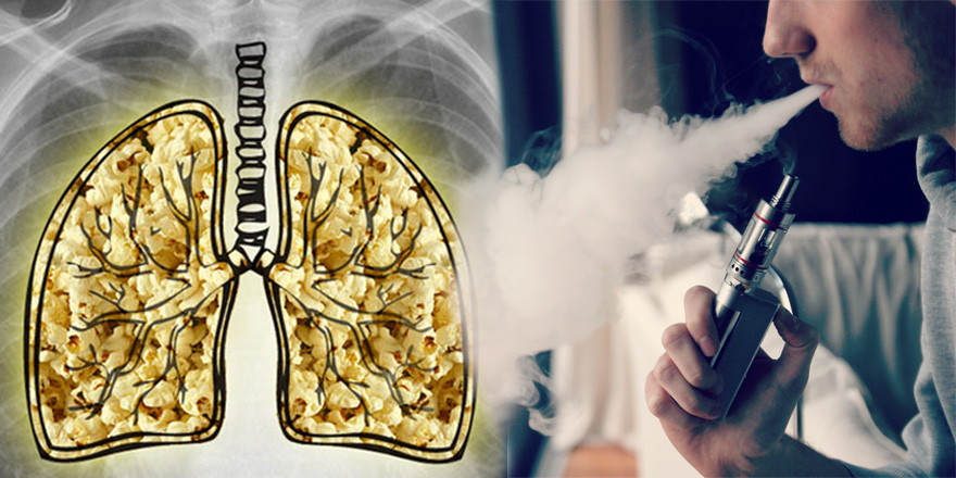 popcorn lung